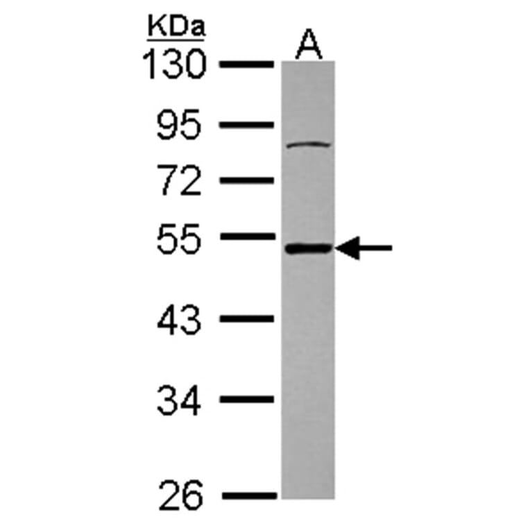 Ataxin 3 antibody from Signalway Antibody (22437) - Antibodies.com