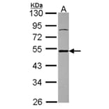 Ataxin 3 antibody from Signalway Antibody (22437) - Antibodies.com