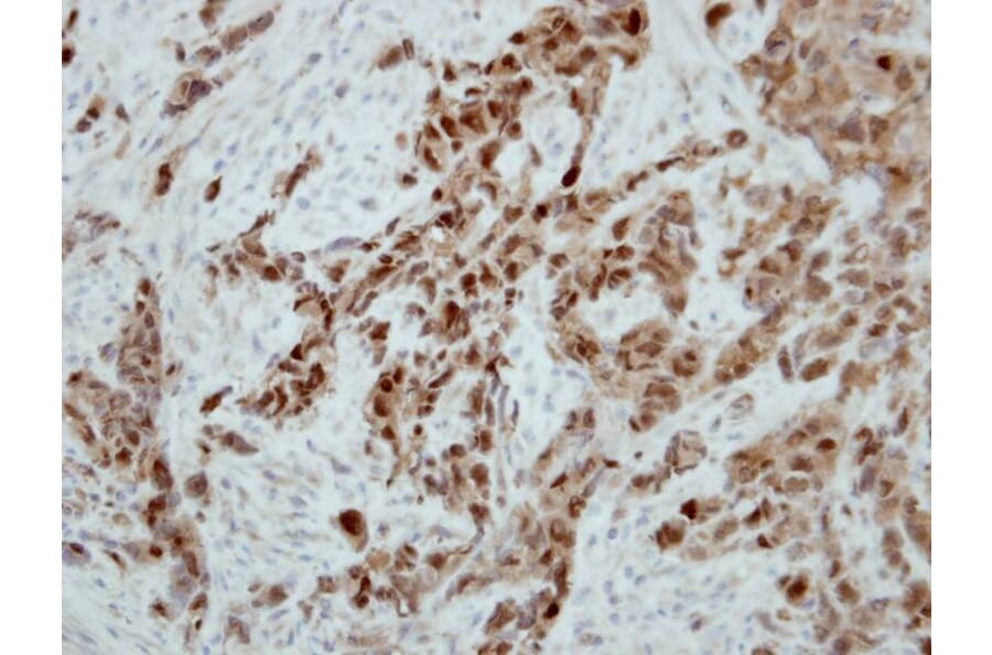 Immunohistochemistry - Ataxin 3 antibody from Signalway Antibody (22437) - Antibodies.com