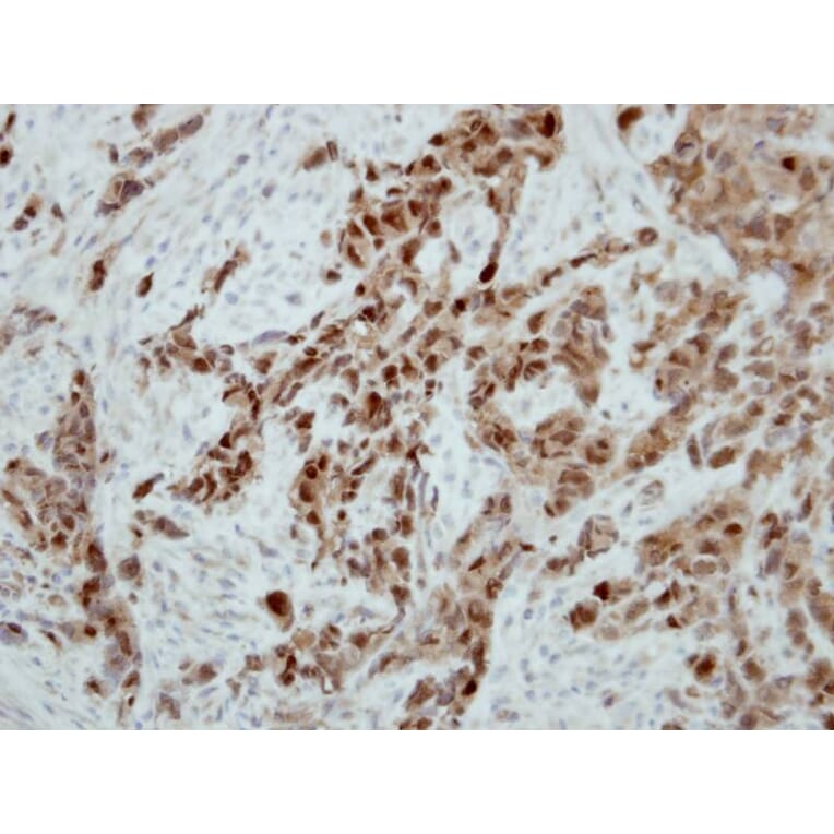 Immunohistochemistry - Ataxin 3 antibody from Signalway Antibody (22437) - Antibodies.com