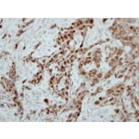 Immunohistochemistry - Ataxin 3 antibody from Signalway Antibody (22437) - Antibodies.com