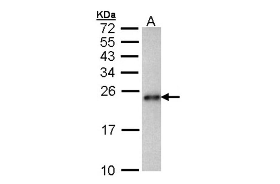 CRHSP-24 antibody from Signalway Antibody (22458) - Antibodies.com
