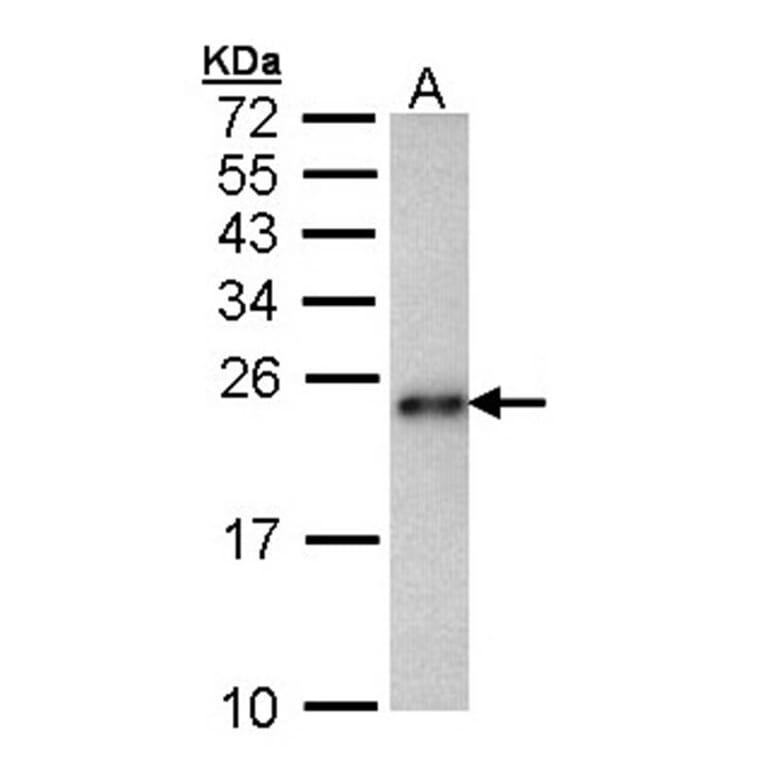 CRHSP-24 antibody from Signalway Antibody (22458) - Antibodies.com