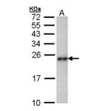CRHSP-24 antibody from Signalway Antibody (22458) - Antibodies.com