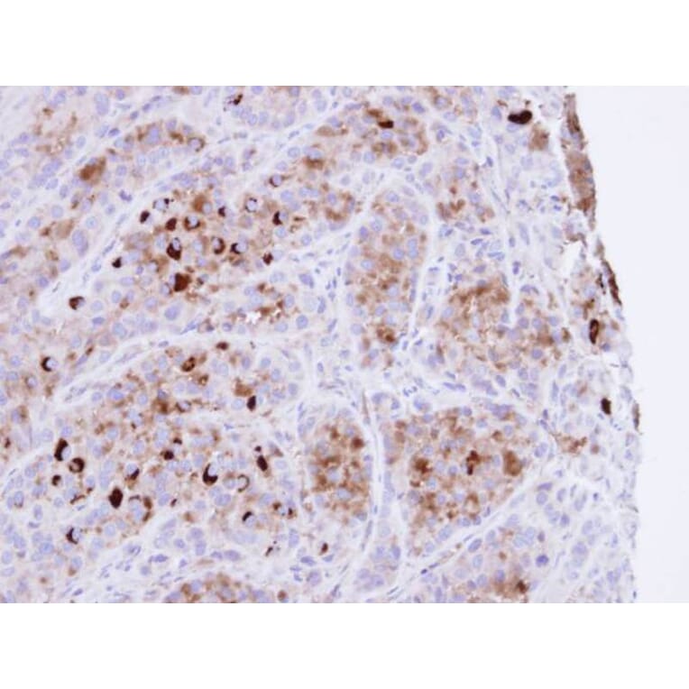 Immunohistochemistry - CRHSP-24 antibody from Signalway Antibody (22458) - Antibodies.com