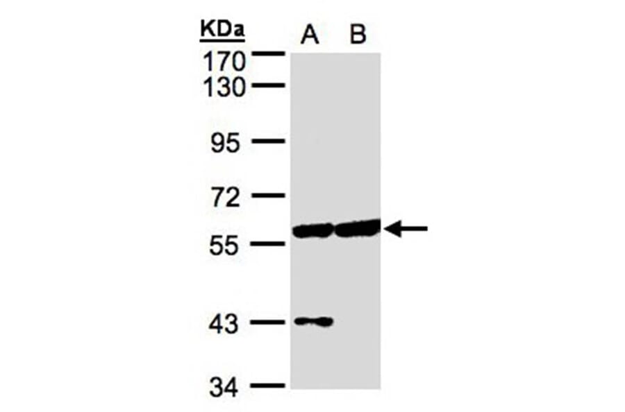 Copine-3 antibody from Signalway Antibody (22698) - Antibodies.com
