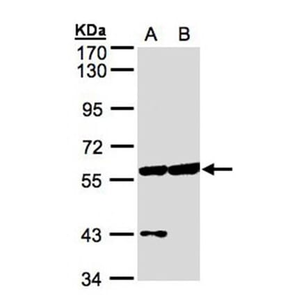 Copine-3 antibody from Signalway Antibody (22698) - Antibodies.com