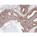 Immunohistochemistry - Copine-3 antibody from Signalway Antibody (22698) - Antibodies.com