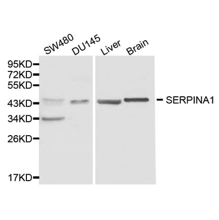 Western blot - SERPINA1 Antibody from Signalway Antibody (32119) - Antibodies.com