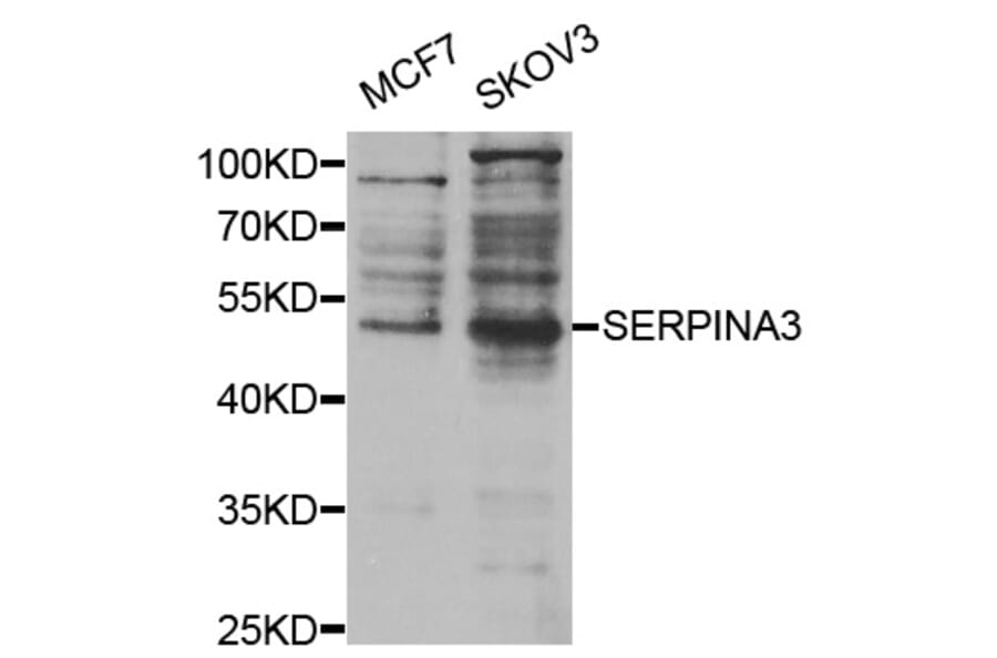 Western blot - SERPINA3 Antibody from Signalway Antibody (32122) - Antibodies.com