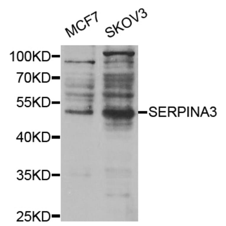 Western blot - SERPINA3 Antibody from Signalway Antibody (32122) - Antibodies.com