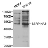 Western blot - SERPINA3 Antibody from Signalway Antibody (32122) - Antibodies.com