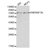 Western blot - TNFRSF1B Antibody from Signalway Antibody (32155) - Antibodies.com