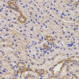 Immunohistochemistry - TNFRSF1B Antibody from Signalway Antibody (32155) - Antibodies.com