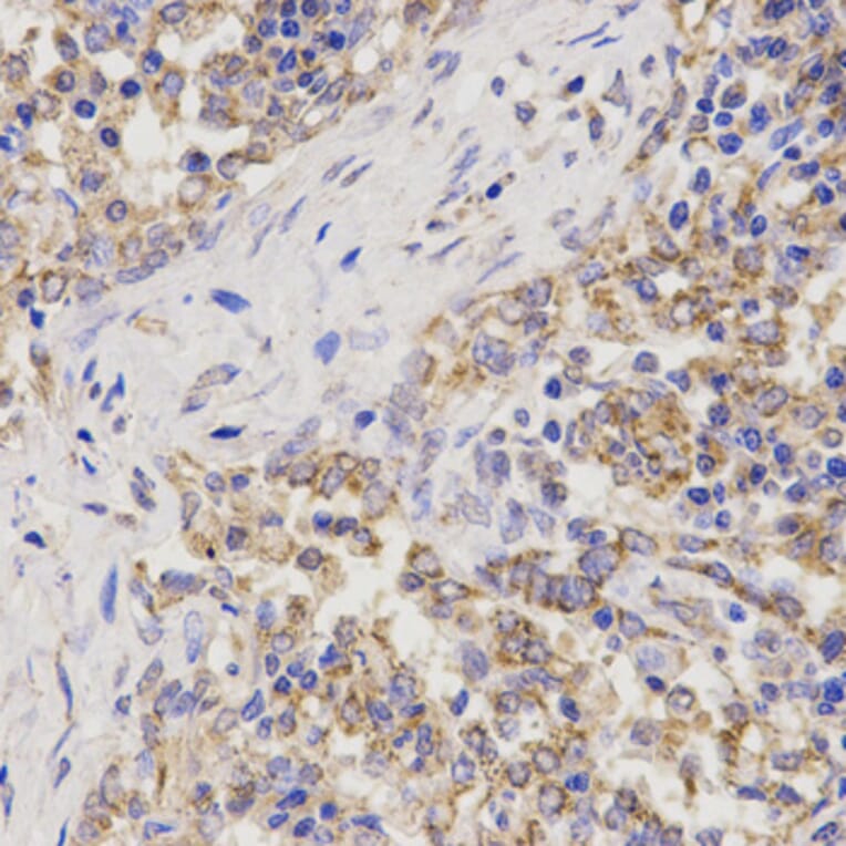 Immunohistochemistry - TNFRSF1B Antibody from Signalway Antibody (32155) - Antibodies.com