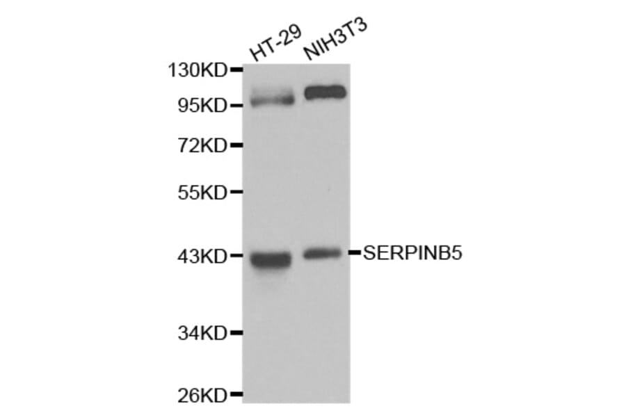 Western blot - SERPINB5 Antibody from Signalway Antibody (32208) - Antibodies.com