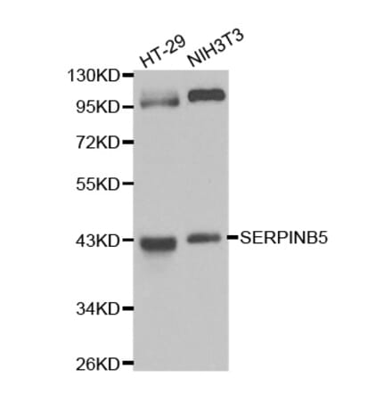 Western blot - SERPINB5 Antibody from Signalway Antibody (32208) - Antibodies.com