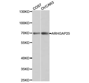 Western blot - ARHGAP25 Antibody from Signalway Antibody (32238) - Antibodies.com