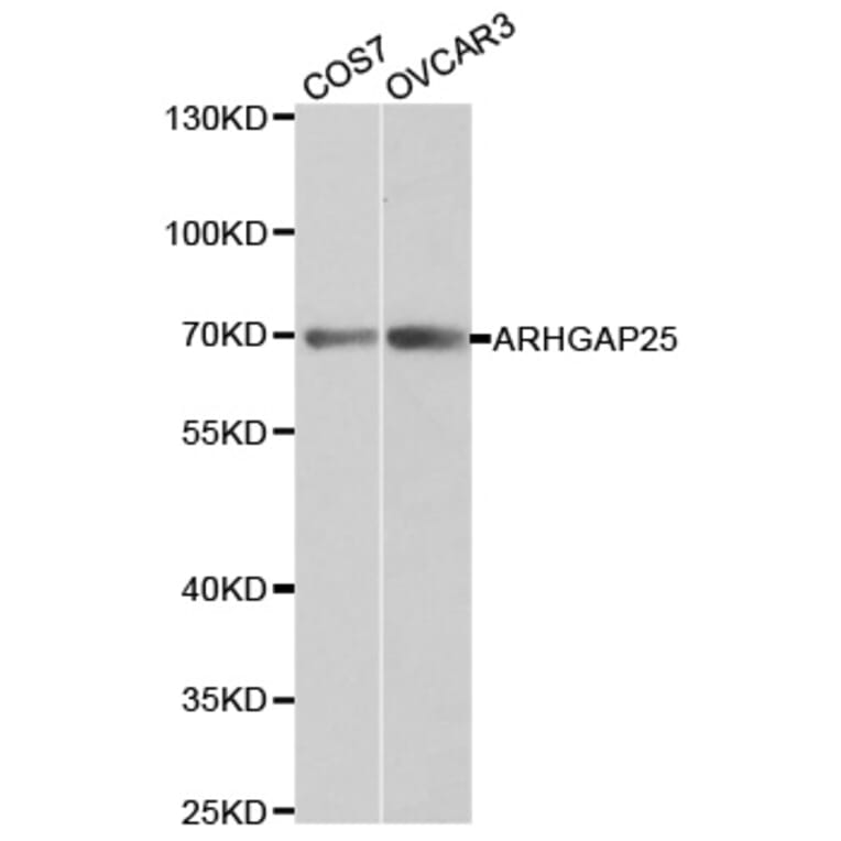Western blot - ARHGAP25 Antibody from Signalway Antibody (32238) - Antibodies.com