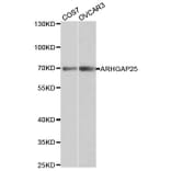 Western blot - ARHGAP25 Antibody from Signalway Antibody (32238) - Antibodies.com