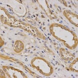 Immunohistochemistry - ARHGAP25 Antibody from Signalway Antibody (32238) - Antibodies.com