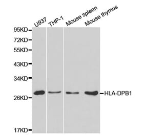 Western blot - HLA-DPB1 Antibody from Signalway Antibody (32274) - Antibodies.com