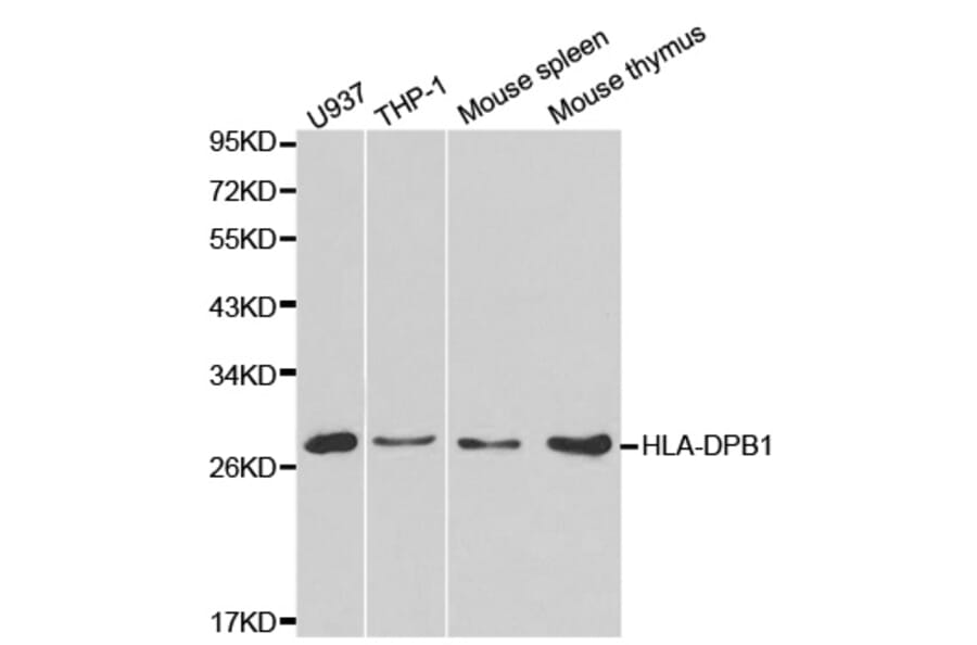 Western blot - HLA-DPB1 Antibody from Signalway Antibody (32274) - Antibodies.com