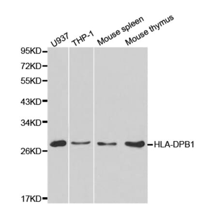 Western blot - HLA-DPB1 Antibody from Signalway Antibody (32274) - Antibodies.com