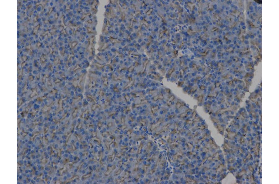 Immunohistochemistry - HLA-DPB1 Antibody from Signalway Antibody (32274) - Antibodies.com