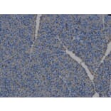 Immunohistochemistry - HLA-DPB1 Antibody from Signalway Antibody (32274) - Antibodies.com