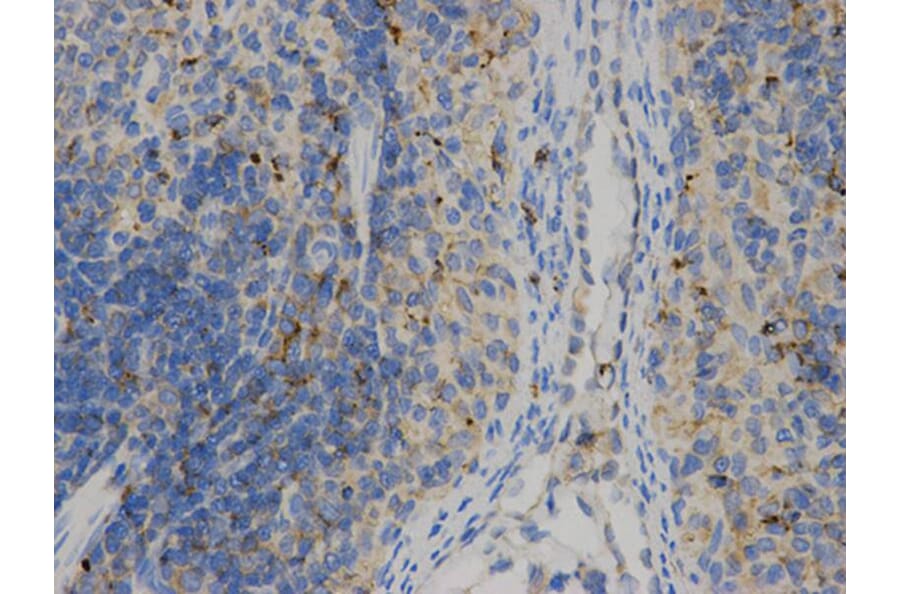 Immunohistochemistry - HLA-DPB1 Antibody from Signalway Antibody (32274) - Antibodies.com