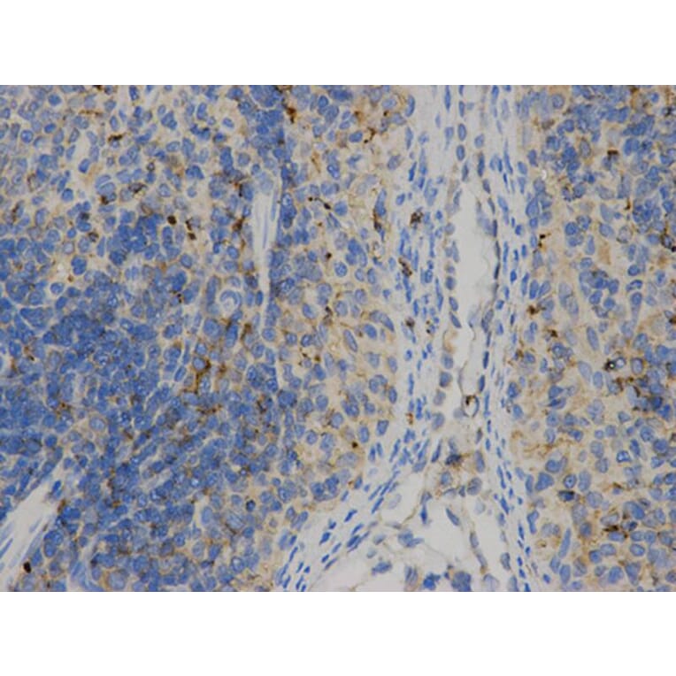 Immunohistochemistry - HLA-DPB1 Antibody from Signalway Antibody (32274) - Antibodies.com