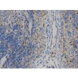Immunohistochemistry - HLA-DPB1 Antibody from Signalway Antibody (32274) - Antibodies.com