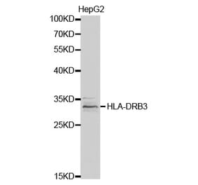 Western blot - HLA-DRB3 Antibody from Signalway Antibody (32340) - Antibodies.com