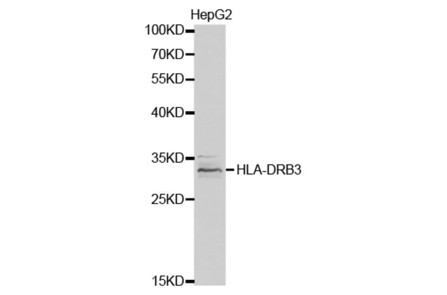 Western blot - HLA-DRB3 Antibody from Signalway Antibody (32340) - Antibodies.com