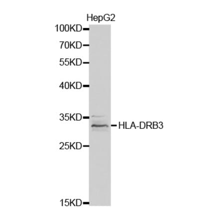 Western blot - HLA-DRB3 Antibody from Signalway Antibody (32340) - Antibodies.com