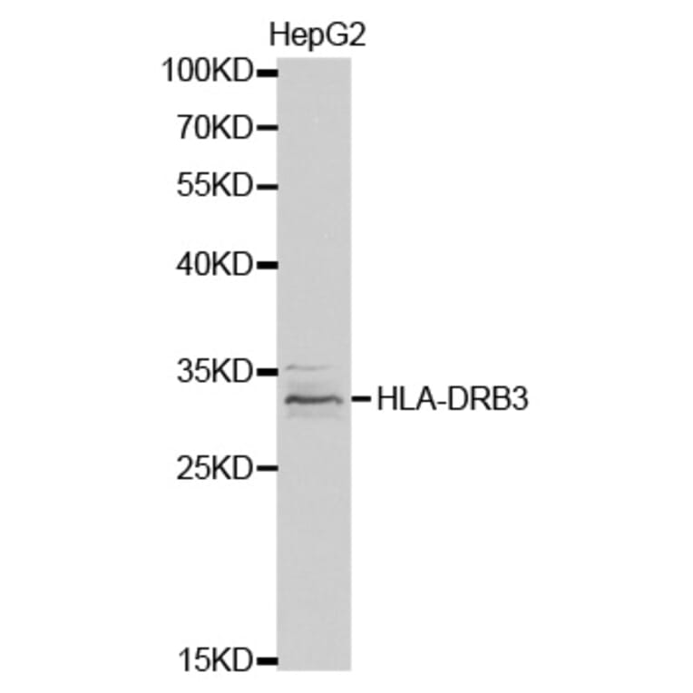 Western blot - HLA-DRB3 Antibody from Signalway Antibody (32340) - Antibodies.com