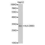 Western blot - HLA-DRB3 Antibody from Signalway Antibody (32340) - Antibodies.com