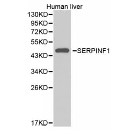 Western blot - SERPINF1 Antibody from Signalway Antibody (32379) - Antibodies.com