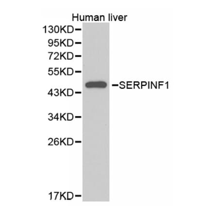 Western blot - SERPINF1 Antibody from Signalway Antibody (32379) - Antibodies.com