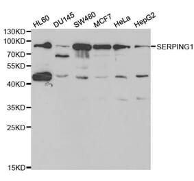 Western blot - SERPING1 Antibody from Signalway Antibody (32401) - Antibodies.com