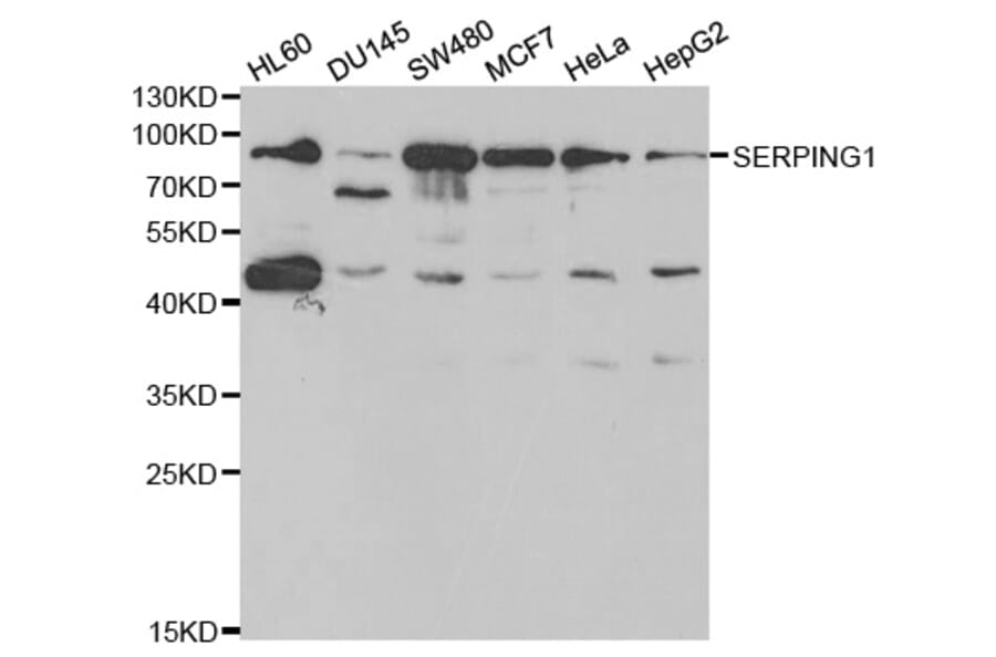 Western blot - SERPING1 Antibody from Signalway Antibody (32401) - Antibodies.com