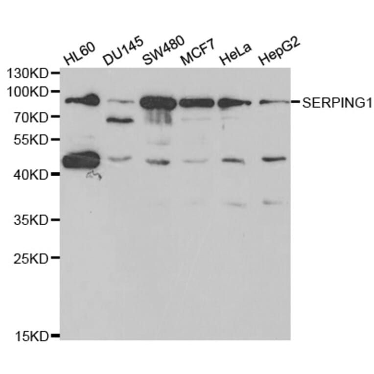 Western blot - SERPING1 Antibody from Signalway Antibody (32401) - Antibodies.com