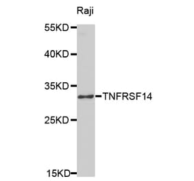 Western blot - TNFRSF14 Antibody from Signalway Antibody (32526) - Antibodies.com