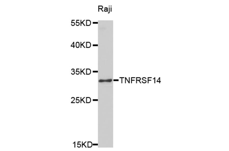 Western blot - TNFRSF14 Antibody from Signalway Antibody (32526) - Antibodies.com