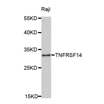 Western blot - TNFRSF14 Antibody from Signalway Antibody (32526) - Antibodies.com