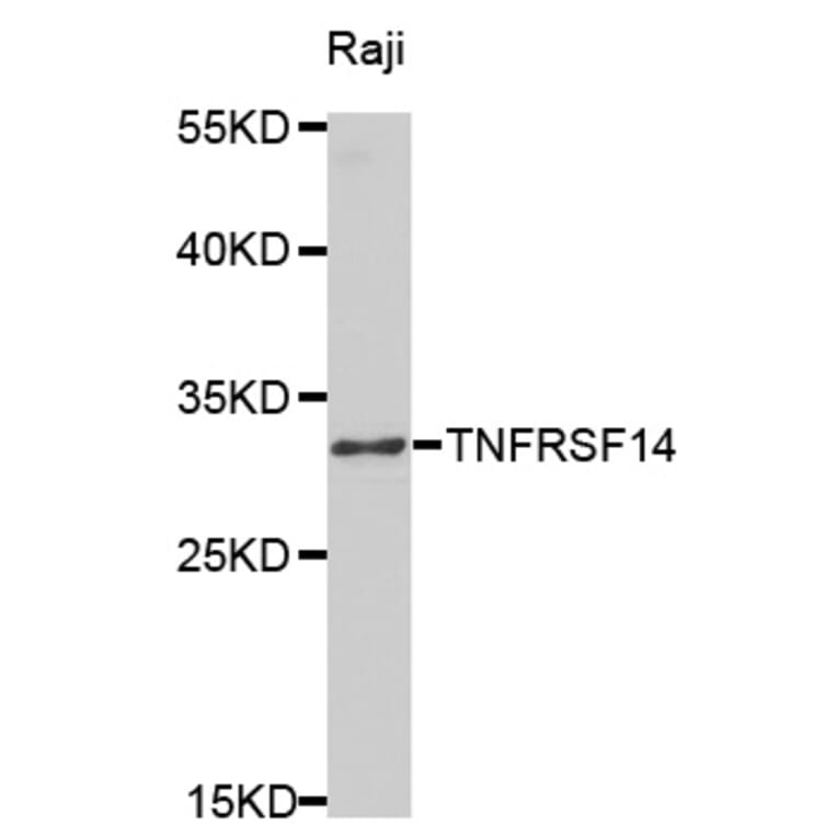 Western blot - TNFRSF14 Antibody from Signalway Antibody (32526) - Antibodies.com