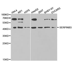 Western blot - SERPINB3 Antibody from Signalway Antibody (32844) - Antibodies.com