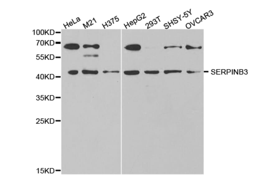 Western blot - SERPINB3 Antibody from Signalway Antibody (32844) - Antibodies.com