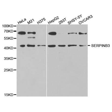 Western blot - SERPINB3 Antibody from Signalway Antibody (32844) - Antibodies.com